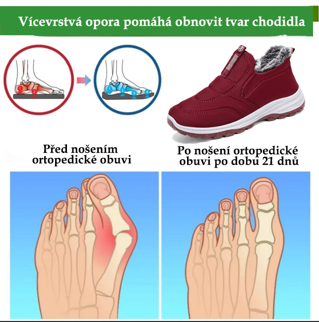 (🔥DNES SLEVA 50 % - NENECHTE SI UJÍT) ⏰ - Měkké a pohodlné zimní italské luxusní značkové semišové ortopedické boty (podpora - úleva od bolesti nohou)